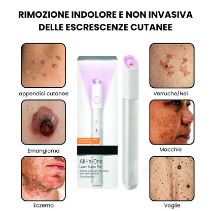 Dispositivo con Tecnologia laser al CO₂