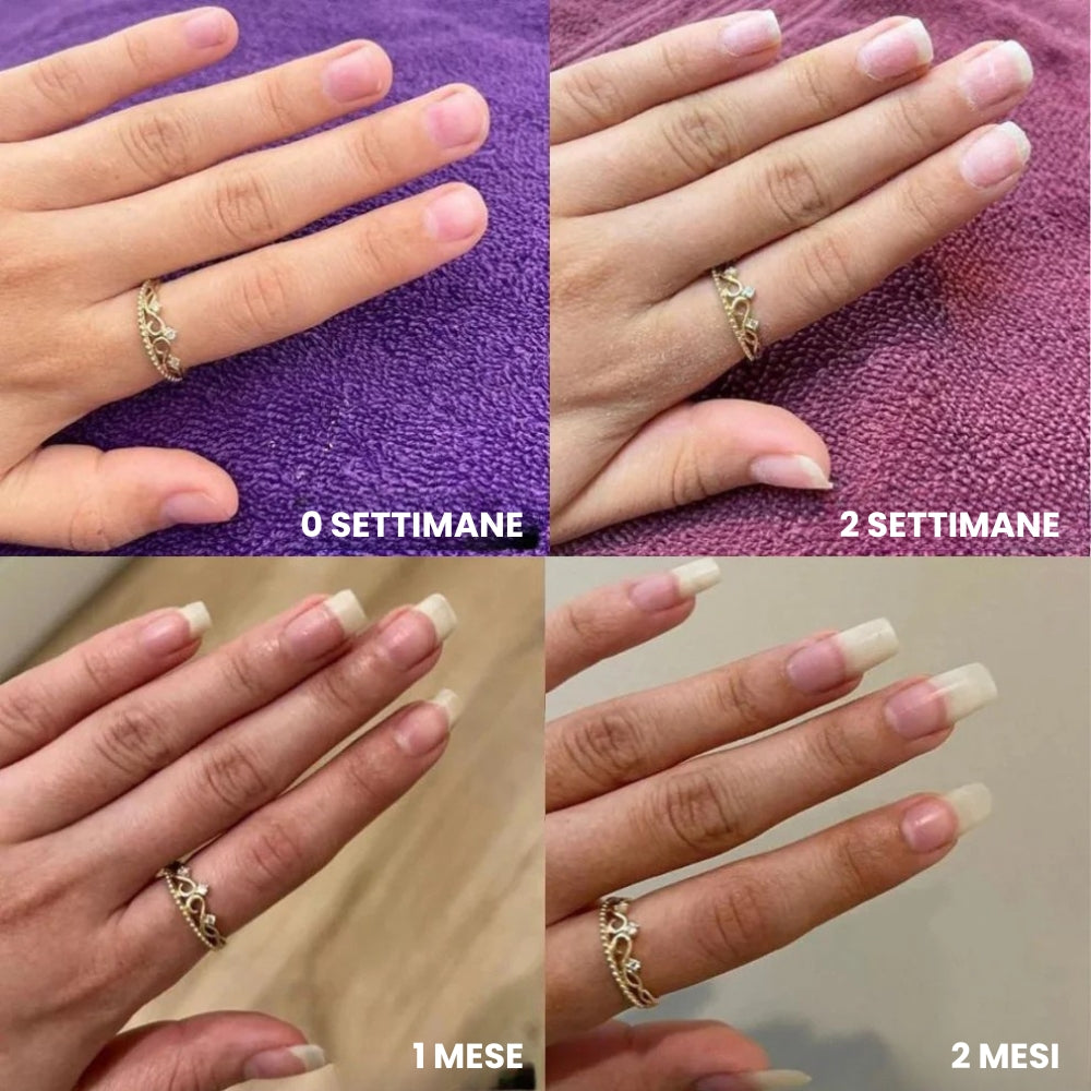 Penna per Crescita Unghie alle Cellule Staminali